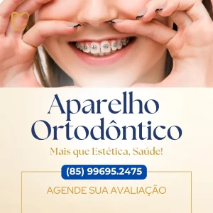 Aparelho Ortodôntico em Fortaleza