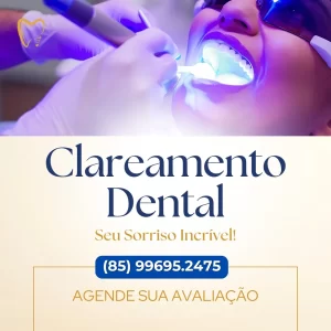 Clareamento Dental em Fortaleza