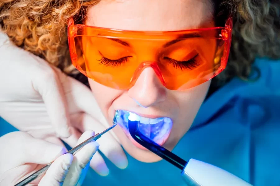 Clareamento Dental Fortaleza Clareamento Laser Fortaleza