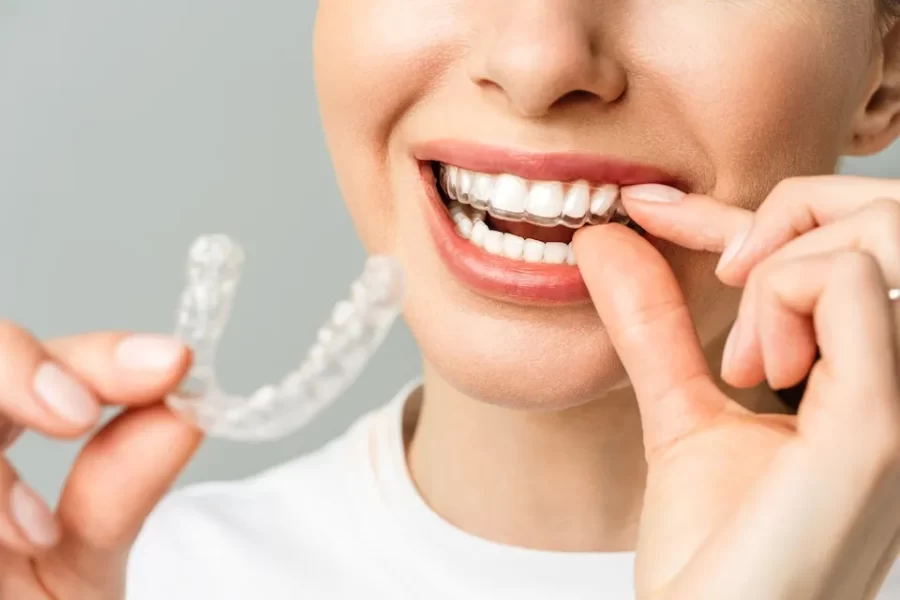 Clareamento Dental Fortaleza Clareamento Laser Fortaleza