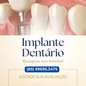 implante dentário em fortaleza