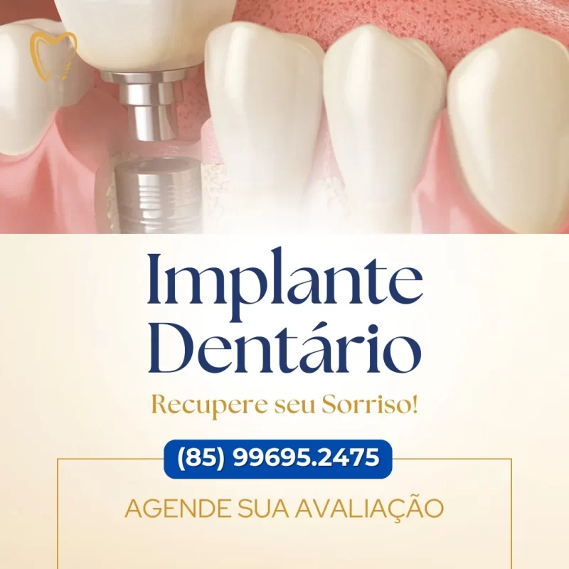 implante dentário em fortaleza