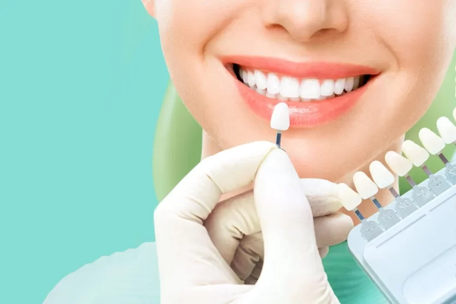 Lentes de Contato Dental em Fortaleza