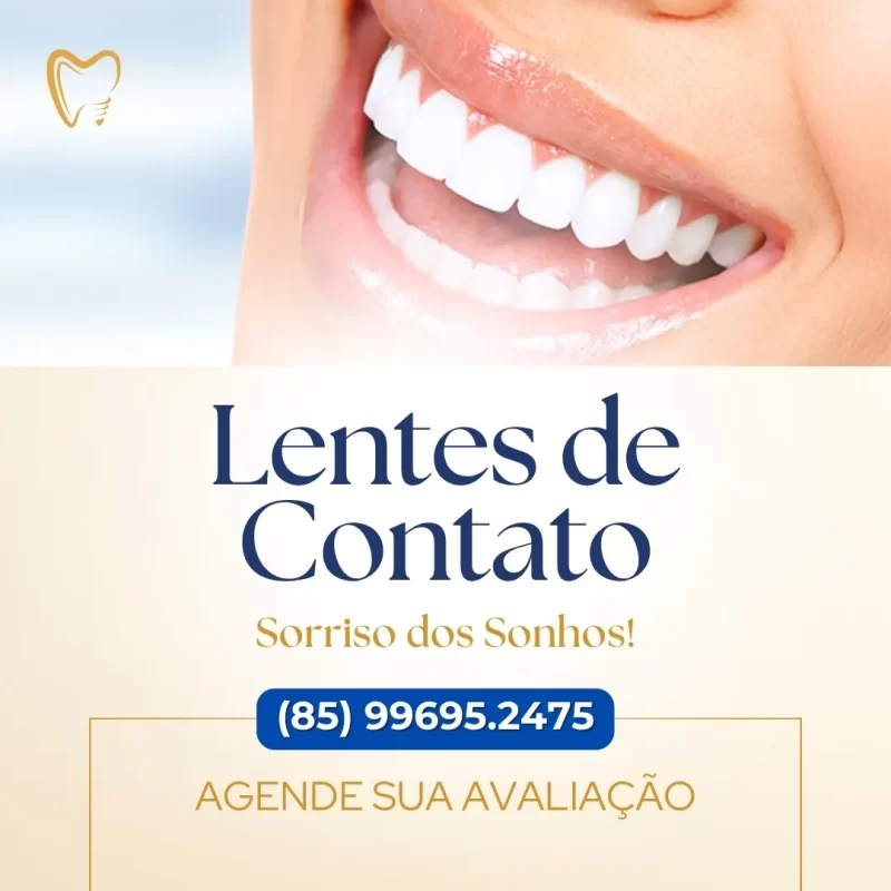 Lentes de Contato para Dentes em Fortaleza