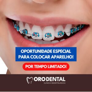Aparelho Ortodôntico no Benfica